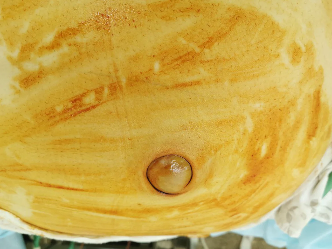 Лікування грижі в Білій Церкві - Фото 8