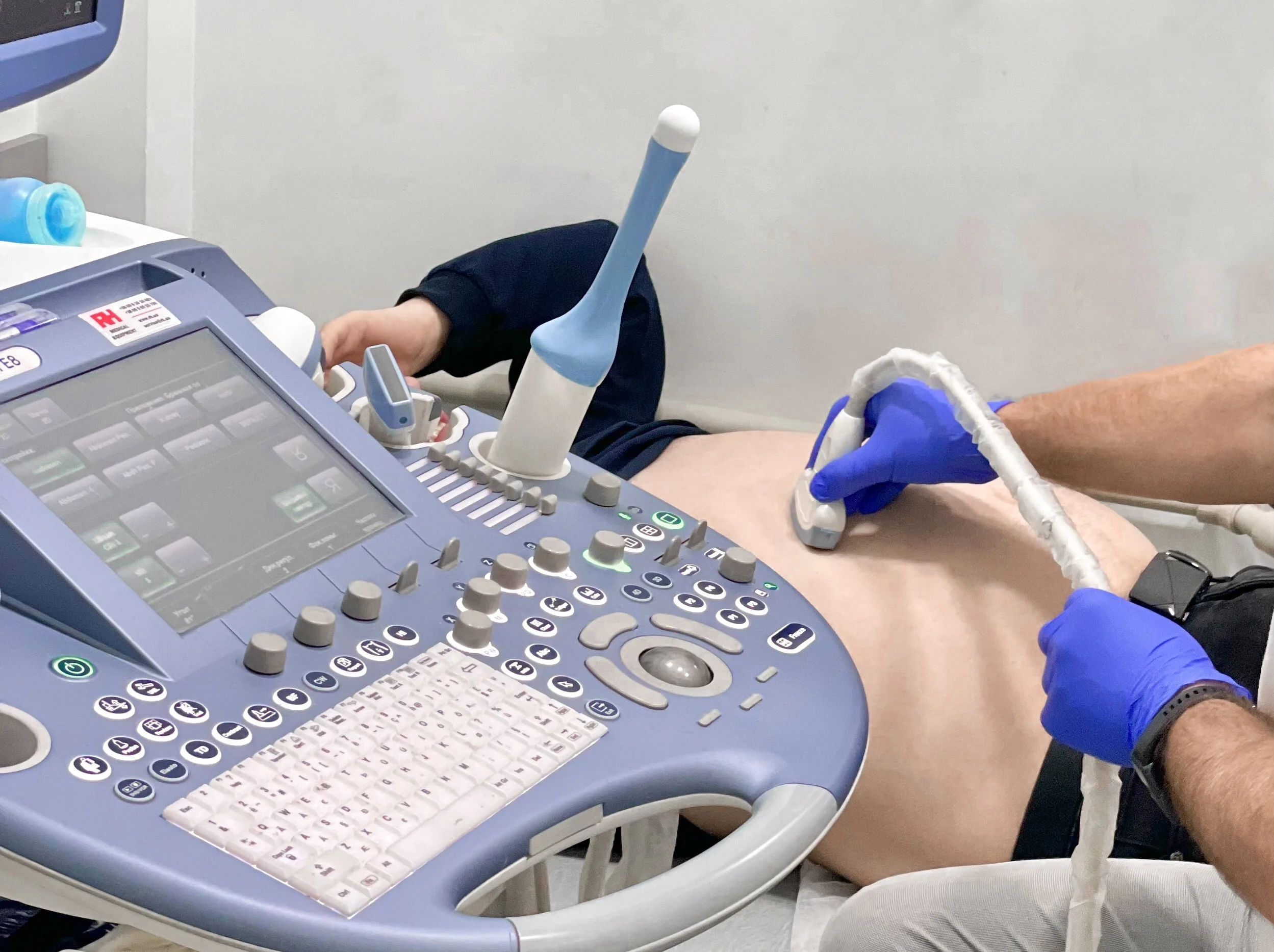 Лікування жовчнокам‘яної хвороби у білій церкві - Фото 8