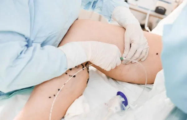 Хірургія - Фото 4